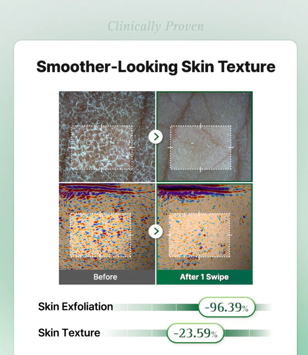 COSRX One Step Original Clear Skin Calming Pad