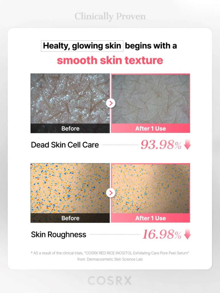 COSRX RED RICE INOSITOL Exfoliating Care Pore Wash-Off Peel Serum