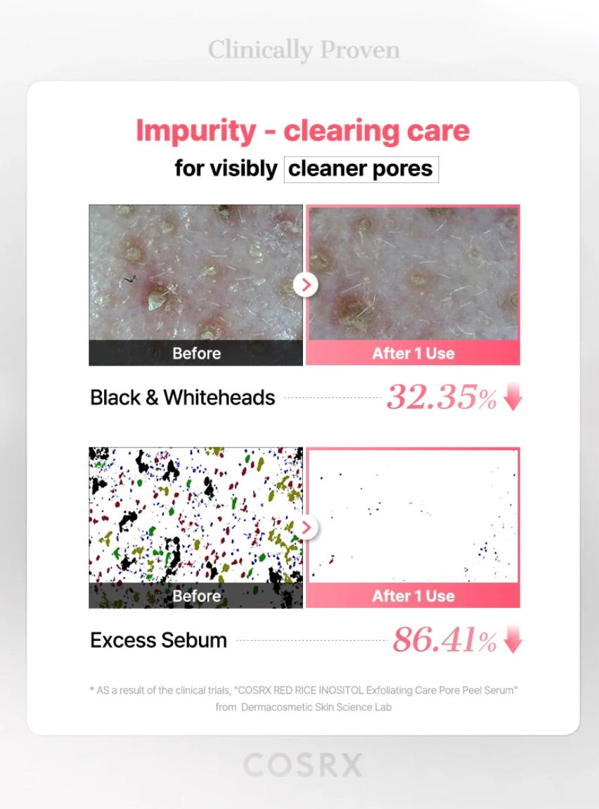 COSRX RED RICE INOSITOL Exfoliating Care Pore Wash-Off Peel Serum
